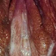 Illustration for article titled Penis saya keluar nanah dan kencing terasa panas terbakar